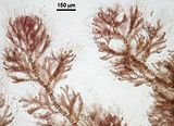 4 - Dettaglio delle ultime ramificazioni con cellule apicali provviste di abbondanti peli